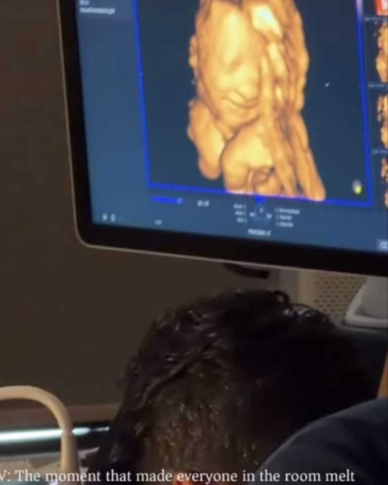 Bebê sorri ao ouvir a voz do pai durante ultrassom 3D e vídeo emociona milhões em redes sociais bebe-sorri-ao-ouvir-a-voz-do-pai-durante-ultrassom-3d-e-video-emociona-milhoes-nas-redes-sociais